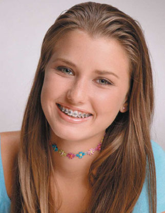 Girl with braces